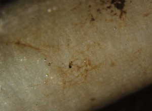 La observación cuidadosa del tejido sano cerca del tejido enfermo revela el micelio marrón característico de <b> <i> Thanatephorus cucumeris </i> </b> (<i> Rhizoctonia solani </i>, "amortiguación", "pudrición del fondo ")