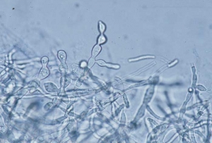Se pueden ver artículos en forma de barril en el micelio;  se consideran esclerocios en blanco.  <b> <i> Thanatephorus cucumeris </i> </b> (<i> Rhizoctonia solani </i>, "amortiguación", "podredumbre del fondo")