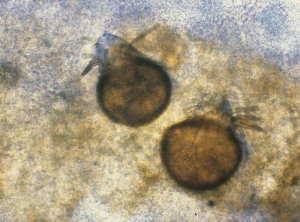 Los picnidios de <b> <i> Pyrenochaeta lycopersici </i> </b> ("raíz fúngica corchosa") tienen cerdas marrones (setas) de tamaño irregular.  Producen conidios elipsoides (4-6 x 1-1,5 µm).