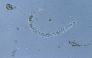 <i> Paratylenchus </i> son nematodos con un estilete bucal largo claramente visible. <b> <i> Paratylenchus sp. </i> </b> 