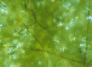 En los tejidos colonizados por <b> <i> Thanatephorus cucumeris </i> </b>, a veces observamos, al usar una lupa binocular, el micelio septado marrón característico de este hongo. 
