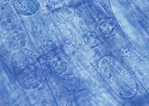 En las células de la corteza de la raíz de plantas enfermas, se puede observar fácilmente la presencia de esporangios y esporas en reposo del hongo vector: <i> Olpidium brassicae </i>. <b><i>Lettuce ring necrosis agent</i></b>, LRNA.