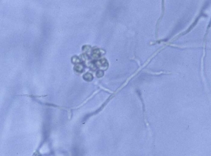 Los oomicetos acuáticos producen <b> zoosporas </b> flageladas a partir de esporangios durante la reproducción asexual, lo que permite que el patógeno se propague.