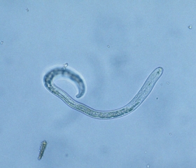 <i> Pratylenchus </i> son nematodos bastante cortos con un estilete bucal prominente.  <b> <i> Pratylenchus penetrans </i> </b> (" lesión de nematodos")