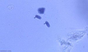 <b> <i> Erysiphe necator </i> </b> ascosporas de cleistotecia también pueden germinar.