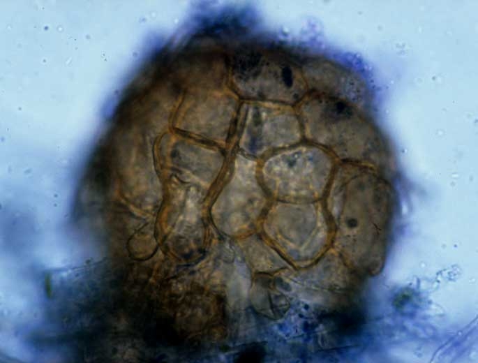 Détail d'un cléistothèce de <i>Podosphaera xanthii</i></b> observé au microscope photonique. On distingue bien la paroi brune de ce dernier. (oïdium)
