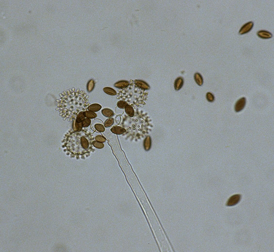 Une observation au microscope optique permet de discerner les vésicules primaires et secondaires constituant en partie le sporocyste.  <i><b>Choanephora cucurbitarum</b></i>