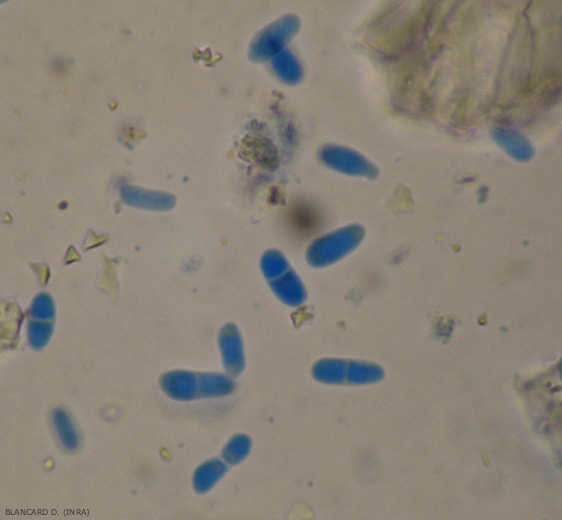 Les pycniospores disposent ou non d'une cloison. Leurs dimensions sont variables d'une conidie à l'autre (3-11 x 2-4,5 µm). <b><i>Didymella lycopersici</i></b> (chancre à <i>Didymella</i>, <i>Didymella</i> stem canker and fruit rot)