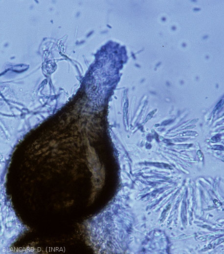 Périthèce de <i>Monographella cucumerina<i/>.  Plusieurs asques contenant des ascospores bicellulaires hyalines sont visibles.