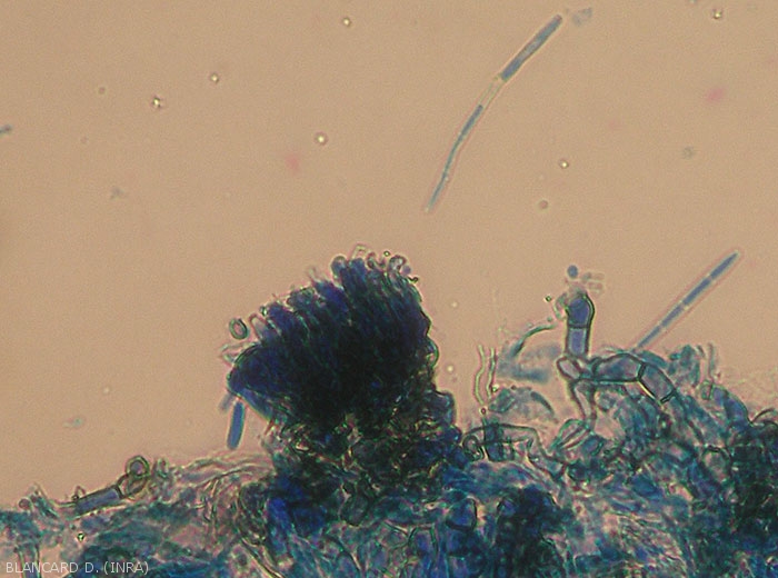 Aspect au microscope photonique d'un bouquet de conidiophore de  <i>Cercospora</i> sp. On distingue aussi quelques conidies allongées et cloisonnées. (cercosporiose)