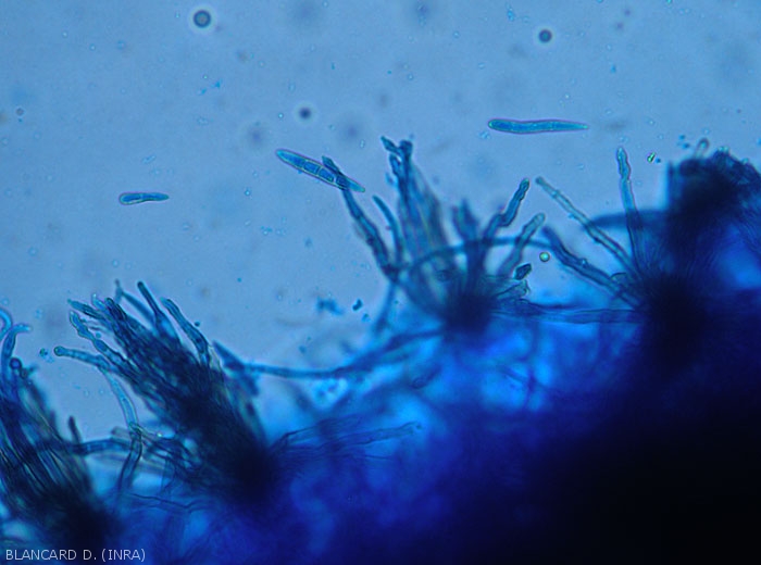 Plusieurs bouquets de conidiophores et quelques conidies sont visibles au microscope photonique sur cette feuille de gombo. <i>Cercospora</i> sp. (cercosporiose)