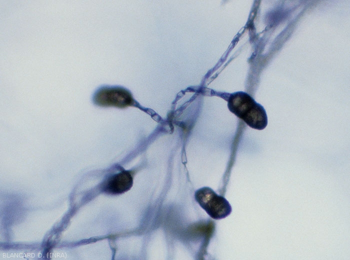 Conidiophores portant des conidies de <i><b>Stemphylium vesicarium</b></i>. (Stemphyliose - grey leaf spot)