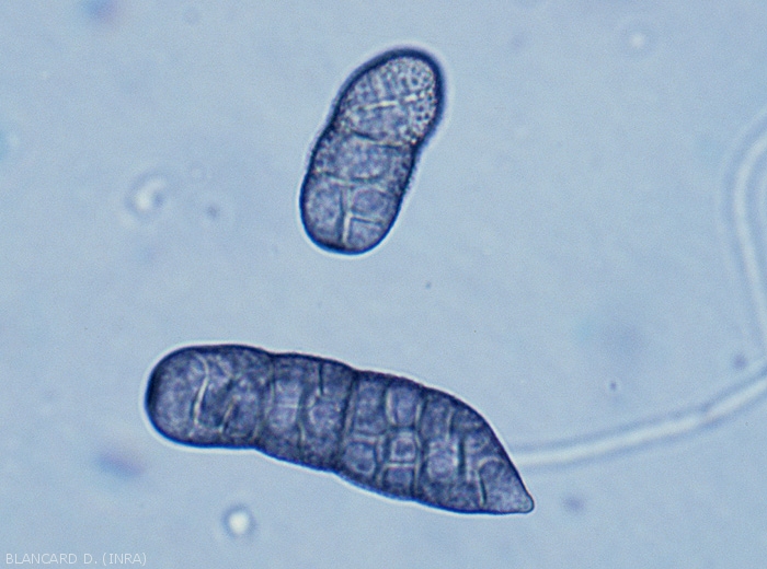 Détail de conidies de <i><b>Stemphylium floridanum</b></i>. Notez leur aspect mûriforme. (Stemphyliose - grey leaf spot)