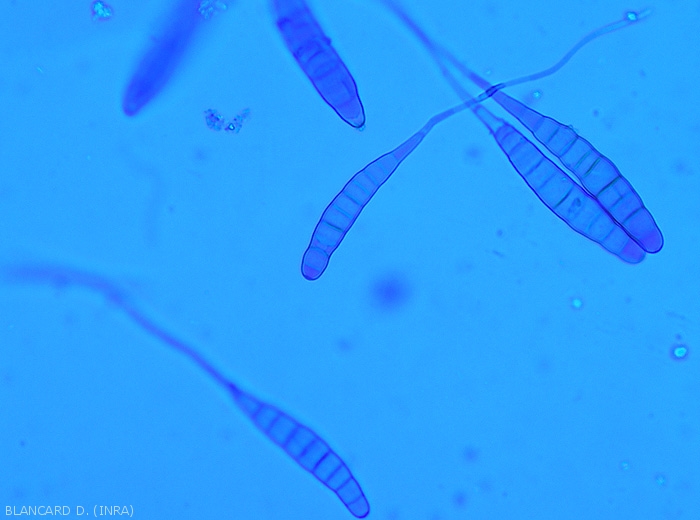Aspect de conidies d'<b><i>Alternaria tomatophila</i></b> observées au microscope photonique. Les spores de ce champignon, pluricellulaires et allongées, sont solitaires et pourvues d'un prolongement hyalin filiforme. <b>Alternariose (early blight)</b>