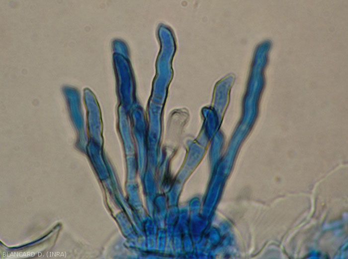 Aspect d'un bouquet de conidiophores tortueux de <i>Pseudocercospora fuligena</i>.  (cercosporiose)