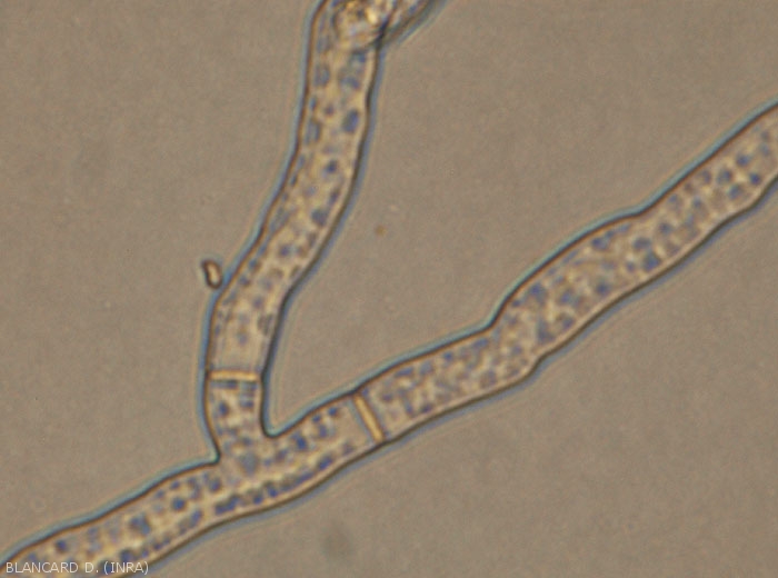 On note également sur le mycélium de <i><b>Rhizoctonia solani</i></b>  une légère constriction au niveau des ramifications latérales, ainsi que la présence de cloisons.