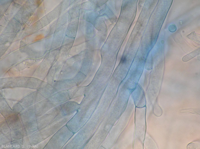 A l'aide d'un microscope photonique, on peut observer le mycélium caractéristique de <i>Rhizoctonia solani</i>.