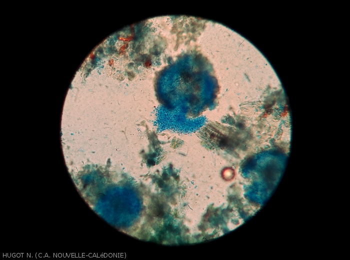 Spores émergeant d'une pycnide d'un <i>Phoma</i> sp. responsable de la criblure du taro.