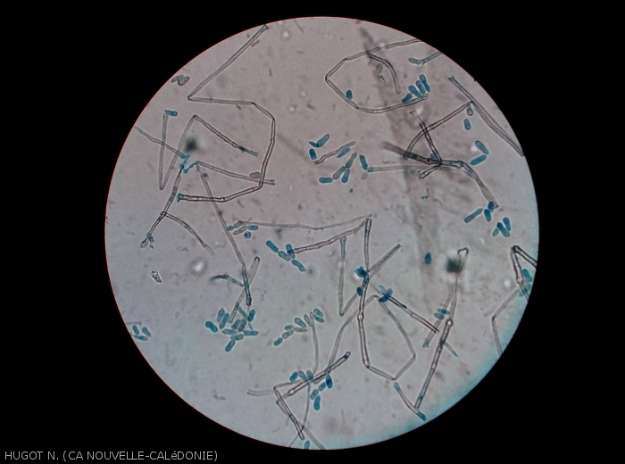 Sur cette vue microscopique d'une sporulation de <i>Cladosporium colocasiae</i>, on remarque bien les conidiophores bruns et septés.
