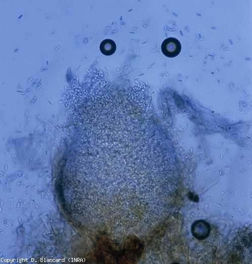 Cette jeune pycnide de <b><i>Didymella lycopersici</i></b>, subglobuleuse à allongée, va progressivement se mélaniser (100 à 270 µm de diamètre). On distingue tout autour de nombreuses conidies. Ajoutons que ce champignon peut former des périthèces (120-150 x 100 µm) à l'origine d'ascospores bicellulaires (16-18 x 5-6,5 µm). <b>Chancre à <i>Didymella</i></b> (<i>Didymella</i> stem canker and fruit rot)
