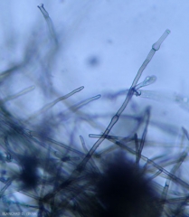 Aspect du mycélium de <b><i>Rosellinia necatrix</i> </b>. (pourridié laineux)