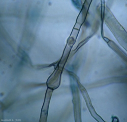 Un renflement est bien visible sur ce mycélium brun et cloisonné de <b><i>Rosellinia necatrix</i></b>. (pourridié laineux)