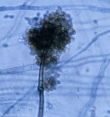Nombreuses conidies brunes, en masse, siutées encore à l'extrémité d'un conidiophore de <b><i>Cladosporium</i> sp.</b> observé au microscope photonique. (pourriture à <i>Cladosporium</i>) 