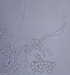 Botrytis_germination