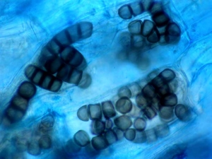<b><i>Thielaviopsis basicola</i></b> (ex <i>Chalara elegans</i>, pourriture noire des racines, black root rot) sur aubergine1