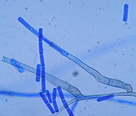 Phialides allongées et endoconidies en chaînes de <i><b>Thielaviopsis basicola</b></i>. (pourriture noire)