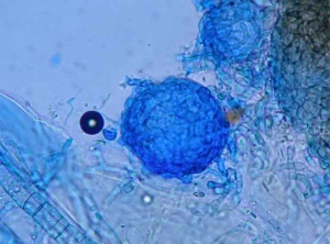 Détail d'une jeune fructification de <i><b>Didymella bryoniae</b></i> vue au microscope photonique. 