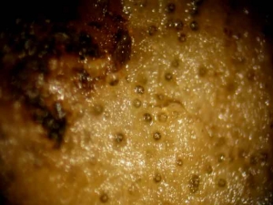 <i></b>Didymella bryoniae</b></i> (chancres gommeux sur tige, gummy stem blight) 5