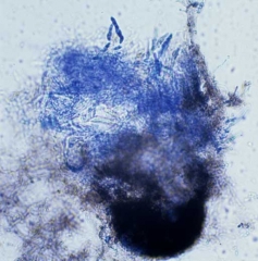 Ce périthèce de <i><b>Didymella bryoniae</b></i>  a été pressé afin de libérer des asques contenant des ascospores qui sont bien visibles au microscope photonique.