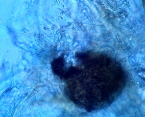 Aspect d'une pycnide globuleuse et  noire de <i><b>Macrophomina phaseolina</b></i> ; son diamètre peut fluctuer entre 100 et 250 µm.