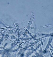 Des structures en forme de tonnelet peuvent être observées sur le mycélium ; elles sont considérés comme des ébauches de sclérotes. <i><b>Thanatephorus cucumeris</b></i> (<i>Rhizoctonia solani</i>)