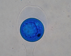 Asque contenant une unique ascospore sphérique encore hyaline.  <i><b>Monosporascus </i>sp.</b>