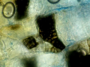 Aspect de pseudo-sclérotes de <i><b>Phomopsis sclerotioides</b></i> au microscope photonique.  (pourriture noire des racines) (black root rot)