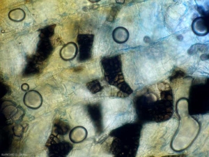 Aspect au microscope photonique des pseudo-sclérotes de <i><b>Phomopsis sclerotioides</b></i>. Ces structures assurent la conservation de ce champignon. (pourriture noire des racines) (black root rot)