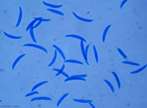 Aspect de quelques macroconidies de <b><i>Fusarium</i> sp. </b> (pourritures des fruits à Fusarium, Fusarium fruit rot)