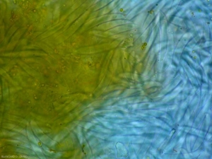 De très nombreuses macroconidies sont formées par les sporodochies (cluster de conidiophores et de conidies) des <b><i>Fusarium</i> spp. </b> (pourritures des fruits à Fusarium, Fusarium fruit rot)