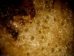 Détail des structures globulaires (pycnides et périthèces) telles qu'on peut les observer sur les tissus altérés. <b><i>Didymella bryoniae</i></b>. (pourriture noire, black rot)(aspect à la loupe binoculaire)