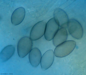 Plusieurs sporanges plus ou moins mélanisés sont visibles sur ce limbe observé au microscope photonique. <i><b>Pseudoperonospora cubensis</b></i>  (mildiou)