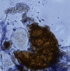 En pressant ce cléistothèce de <i>Podosphaera xanthii</i></b>, il a été possible d'extraire un asque contenant 8 ascospores. (oïdium ou blanc, powdery mildew, white mold)