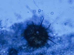 P.lycopersici-Pycnide1.jpg