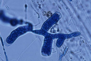 Cet hyphe mycélien, terminal et ramifié, est en fait un sporange filamenteux enflé de <b><i>Pythium aphanidermatum</i></b> ("damping-off").