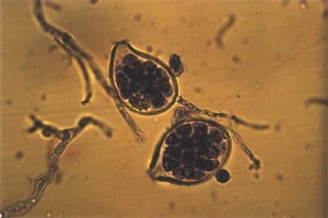 Deux sporanges papillés sont remplis de zoospores mobiles. <i><b>Phytophthora nicotianae</i></b> (black shank), chromiste hétérothallique, produit aussi des chlamydospores plutôt sphériques ainsi que des oospores disposant d'une paroi épaisse.