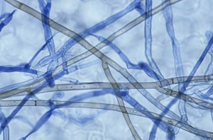 Le mycélium de <i><b>Thanatephorus cucumeris</b></i> (<i>Rhizoctonia solani</i>, damping-off) brunit (se mélanise) en vieillissant. Il est cloisonné et montre une constriction à l'endroit où se forment les ramifications à 45° très caractéristiques du champignon.