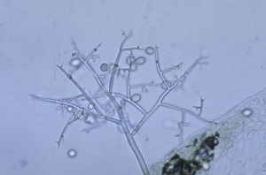 <b><i>Peronospora hyoscyami</i> f.sp. <i>tabacina</i></b> (mildiou du tabac, downy mildew) produit surtout des conidiophores arbusculeux, portant des sporanges en forme de citron.

