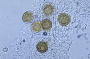 Dans les tissus altérés, on observe aussi des oospores brunes , elles assurent la reproduction sexuée de ce champignon. <b><i>Peronospora hyoscyami</i> f.sp. <i>tabacina</i></b> (mildiou du tabac, downy mildew)

