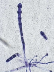 <b><i>Golovinomyces cichoracearum</i> var. <i>cichoracearum</i></b> (oïdium, powdery mildew) forme couramment des conidies en chaîne à l'extrémité de courts conidiophores.